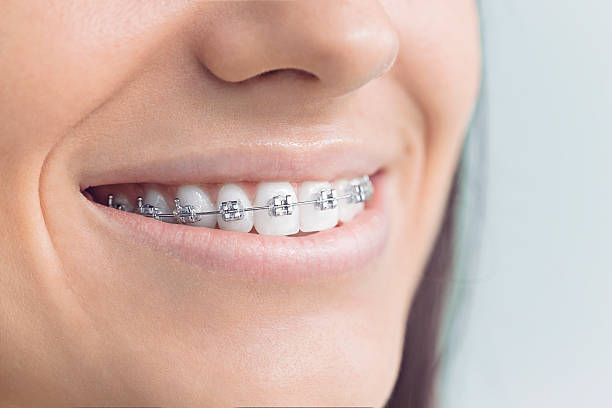 Best Dental Fillings (Composite and Amalgam)  in South Glens Falls, NY